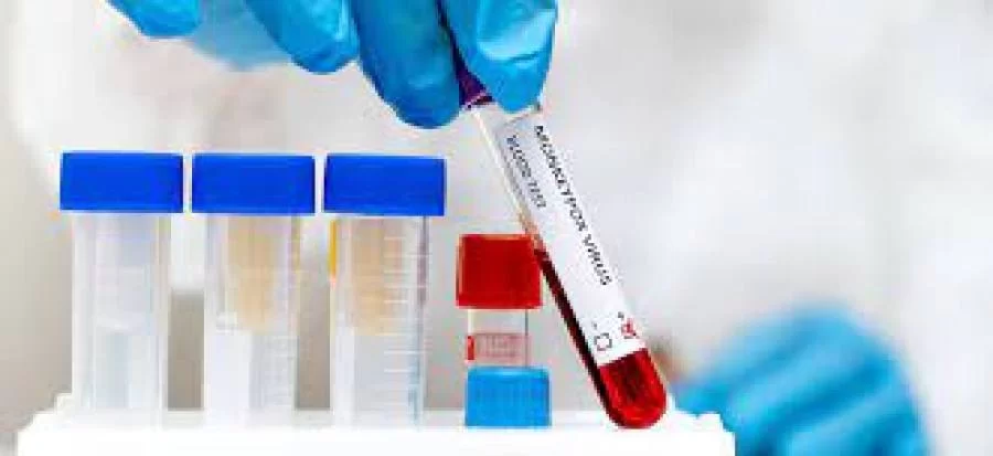 Cresce número de supostos casos de monkeypox no Tocantins; balanço aponta para 13