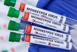 Terceiro caso da varíola dos Macacos no Estado é confirmado em Araguaína