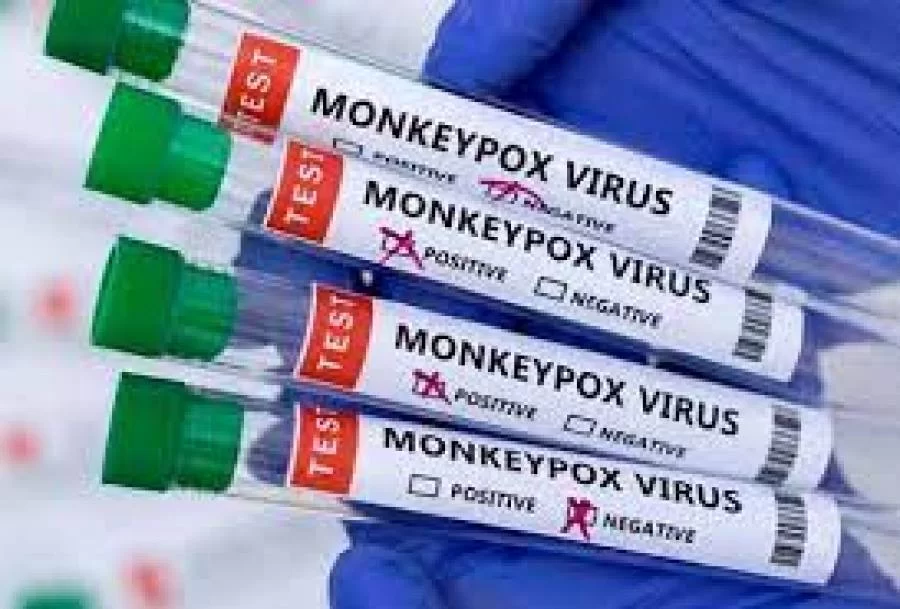 Terceiro caso da varíola dos Macacos no Estado é confirmado em Araguaína