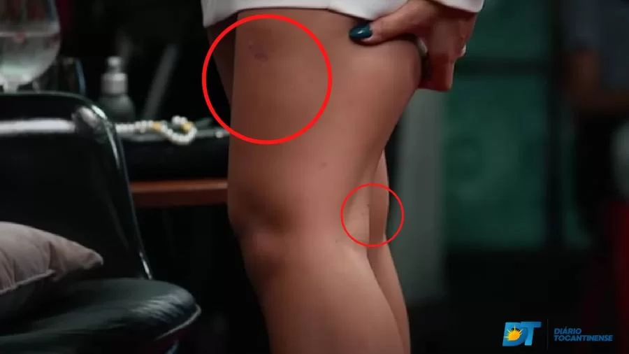 Atriz de Pantanal é mordida por jacaré, "Ele abriu toda a boca. Era muito grande", diz a personagem Muda