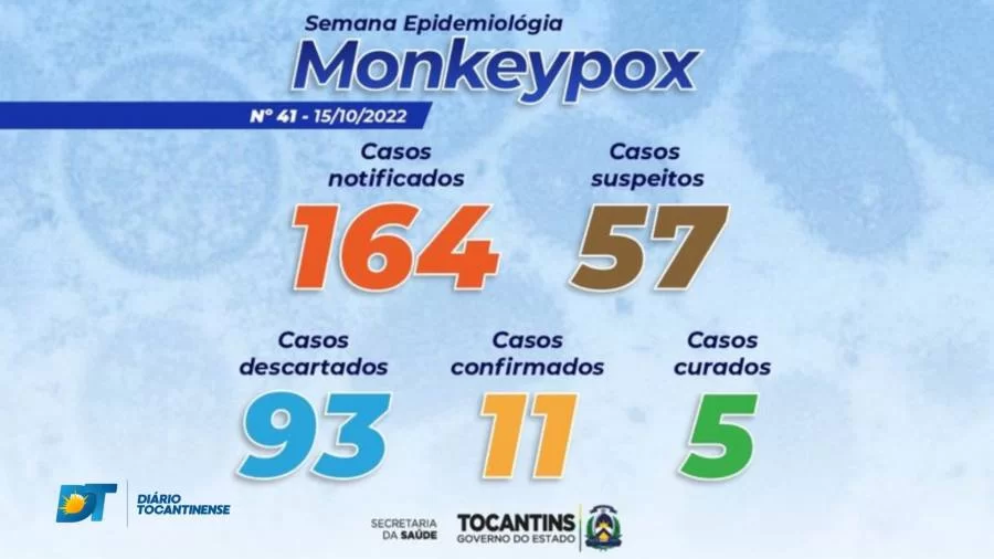 Casos de Monkeypox aumentam no Tocantins