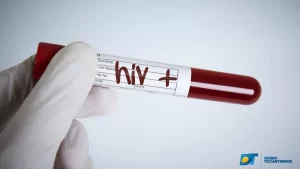 Pessoas portadoras de HIV tem direito ao benefício assistencial? saiba o que diz lei sobre o assunto;