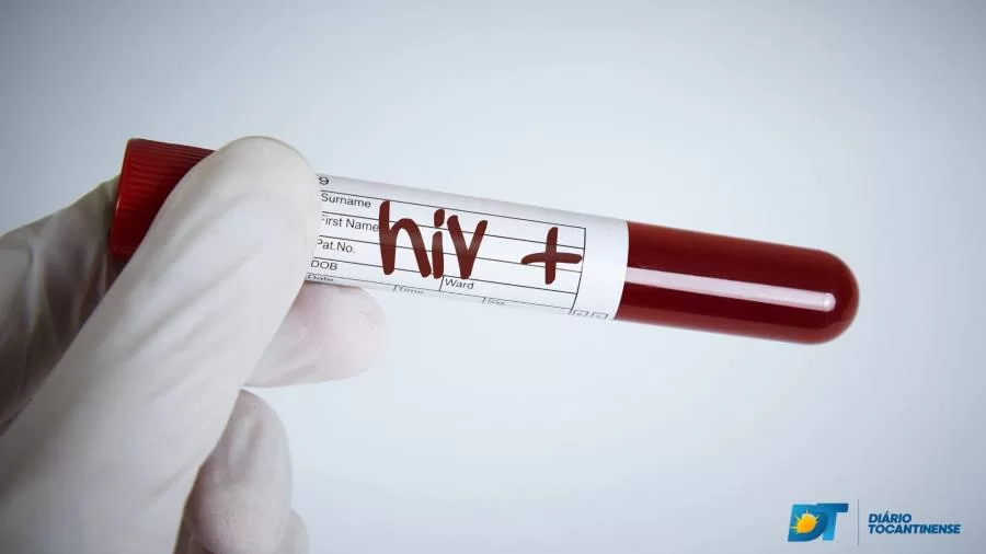 Pessoas portadoras de HIV tem direito ao benefício assistencial? saiba o que diz lei sobre o assunto;