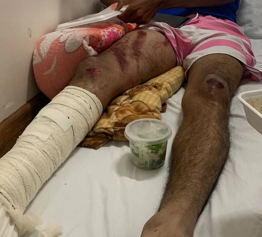 Família pede ajuda para cirurgia de jovem atropelado por motorista embriagado