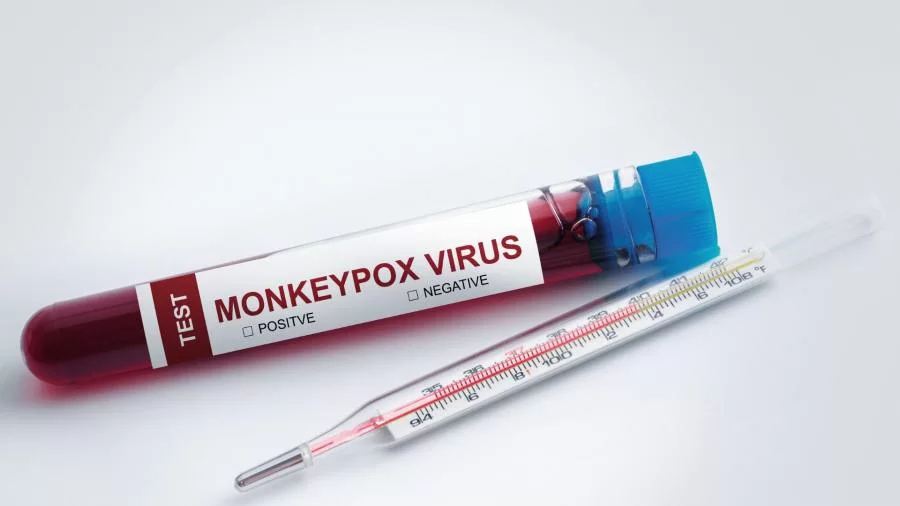 Monkeypox: Tocantins confirma 12 casos e 79 notificações de varíola dos macacos