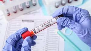 Estado do Tocantins confirma 38 casos suspeitos de Monkeypox