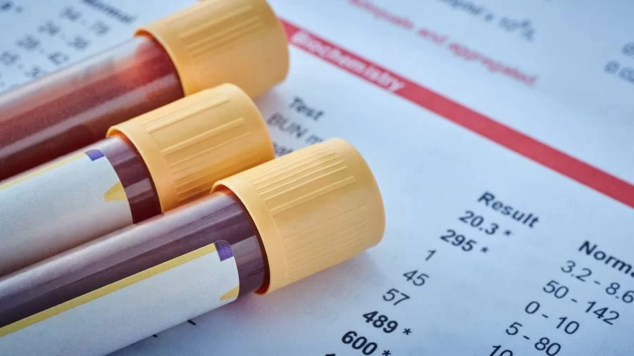 Farmácias começam a fazer exames de análise clínica; confira