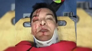 Regis Danese tem intestino perfurado e braço quebrado em acidente de carro em Goiás