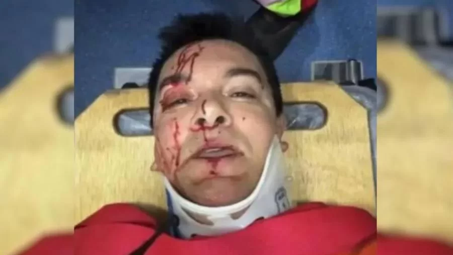 Regis Danese tem intestino perfurado e braço quebrado em acidente de carro em Goiás