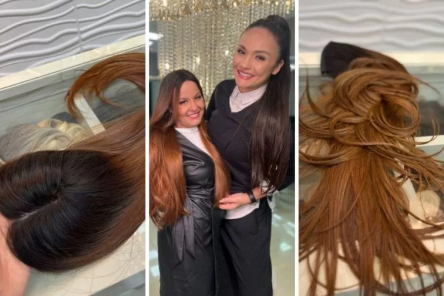 Maiara da dupla com Maraísa é diagnosticada com alopecia; doença causa queda de cabelo