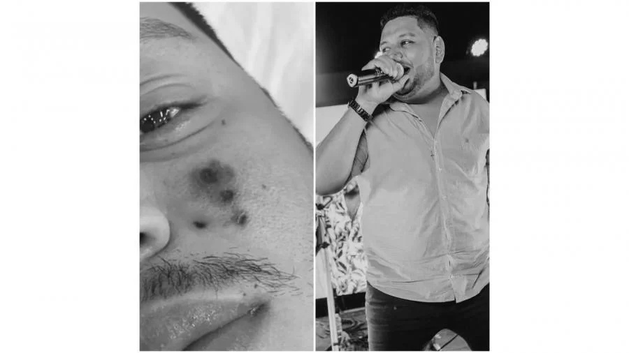 Cantor Tocantinense morre após ser picado por aranha