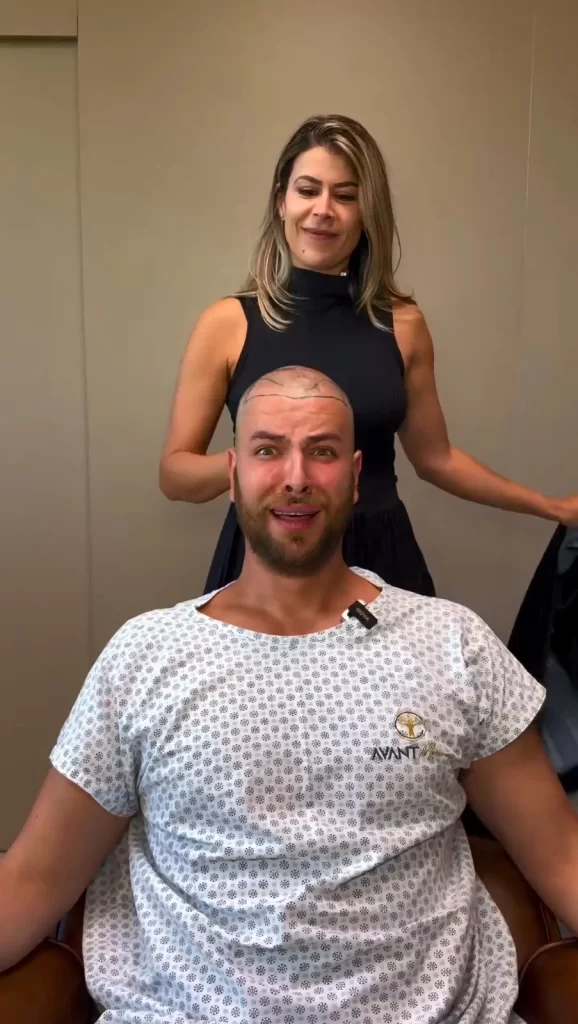 Gustavo Marsengo faz transplante capilar antes do casamento com Laís Caldas