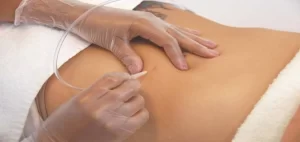 Especialista indica tratamentos estÃÂ©ticos que podem trazer bons resultados a tempo do carnaval