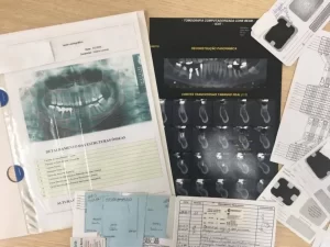 Policia CientÃÂ­fica alerta sobre a necessidade de manutenÃÂ§ÃÂ£o de prontuÃÂ¡rios odontolÃÂ³gicos para identificaÃÂ§ÃÂ£o cadavÃÂ©rica