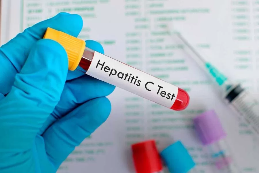 No Tocantins, quase 100 casos de hepatite foram diagnosticados este ano
