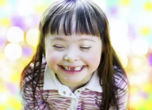 Acompanhamento mÃÂ©dico desde a infÃÂ¢ncia ÃÂ© fundamental para portadores da SÃÂ­ndrome de Down