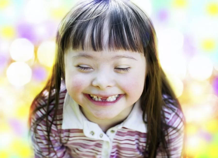 Acompanhamento mÃÂ©dico desde a infÃÂ¢ncia ÃÂ© fundamental para portadores da SÃÂ­ndrome de Down