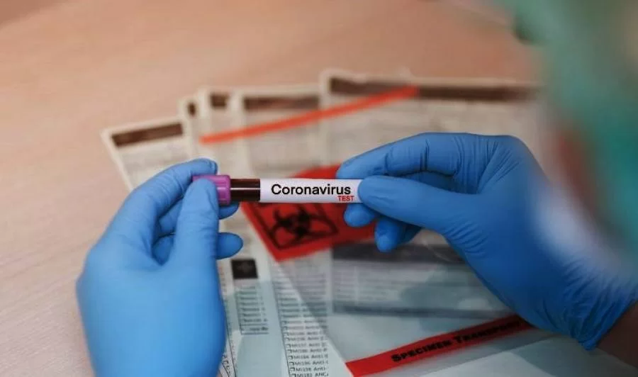 Sobe o nÃÂºmero de casos confirmados de coronavÃÂ­rus no Tocantins