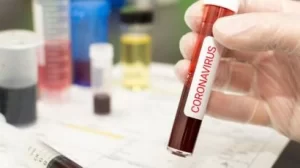 Tocantins contabiliza 99 novos casos de Covid-19 nesta quinta-feira