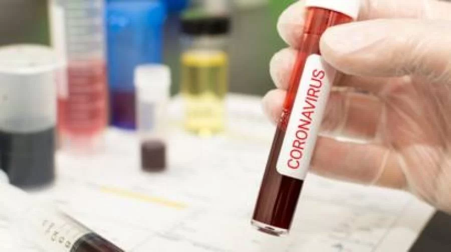 Tocantins contabiliza 99 novos casos de Covid-19 nesta quinta-feira