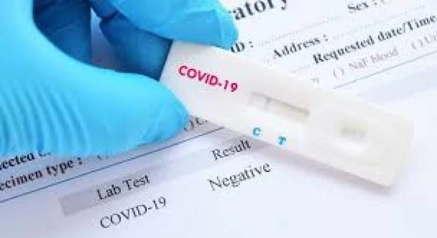Tocantins contabiliza 113 novos casos confirmados da Covid-19