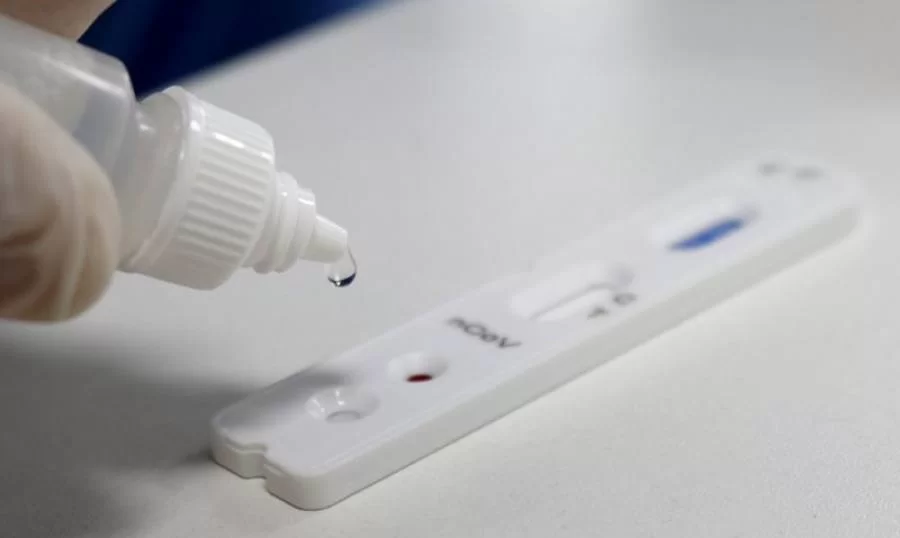 FarmÃÂ¡cias poderÃÂ£o fazer testes rÃÂ¡pidos de Covid-19