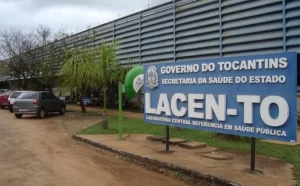 Tocantins tem 270 novos infectados e contabiliza total de 3.277 casos de pessoas que contraÃÂ­ram a Covid-19