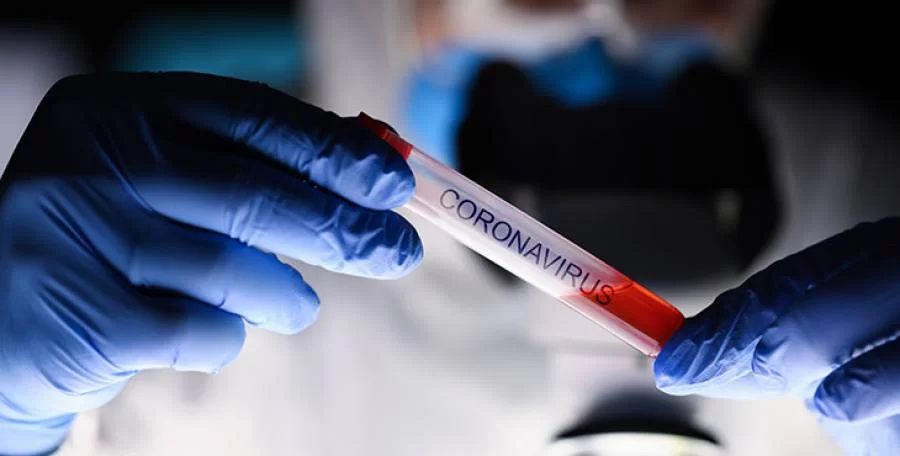 Pandemia: Tocantins tem mais 246 casos confirmados do novo coronavÃÂ­rus