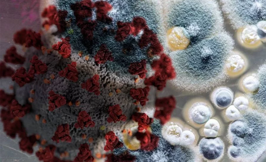 Urgente! Cidade de Conceição do Araguaia no Pará que divide fronteira com o estado do Tocantins registra primeiro caso de fungo negro