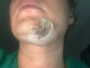 Exclusivo: Joice Hasselmann diz que acordou com traumas no corpo e poça de sangue, caso é investigado
