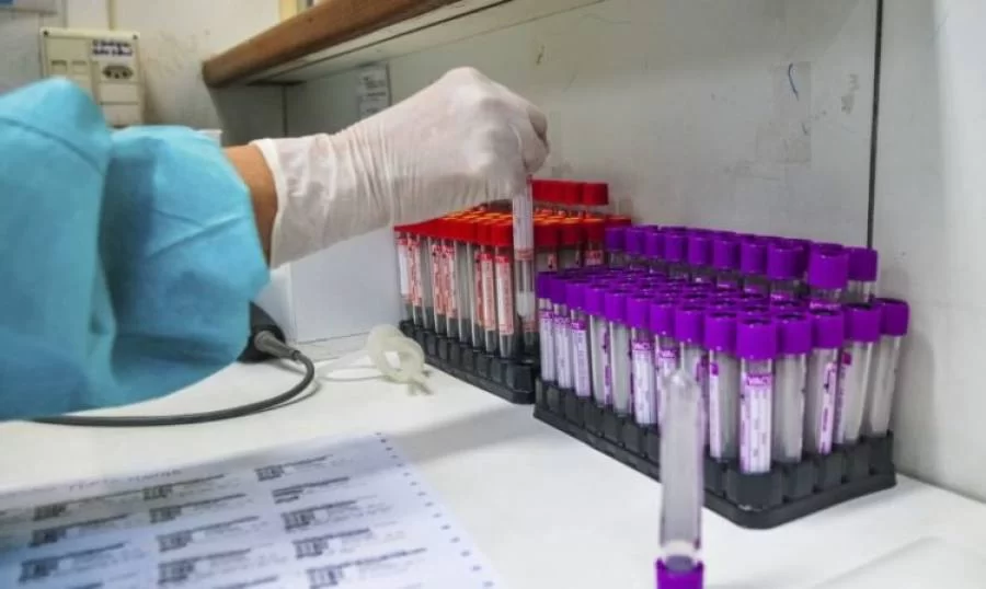 Nova variante conhecida por 'Gama Plus' é identificada no Tocantins