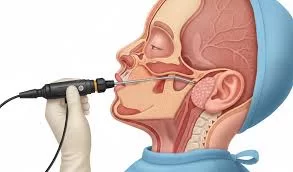 Saúde — Adenoide: quando vira caso de cirurgia e como os sintomas afetam crianças no Tocantins