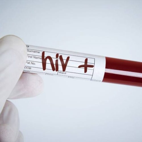 Pessoas portadoras de HIV tem direito ao benefício assistencial? saiba o que diz lei sobre o assunto;