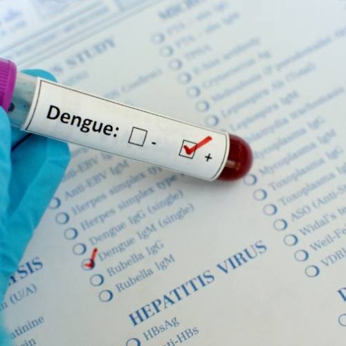 Diagnóstico precoce da dengue é fundamental para evitar complicações e salvar vidas