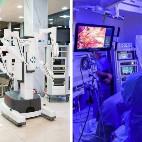 Hospital Santa Thereza em Palmas realiza a primeira cirurgia utilizando robótica com tecnologia avançada no Estado