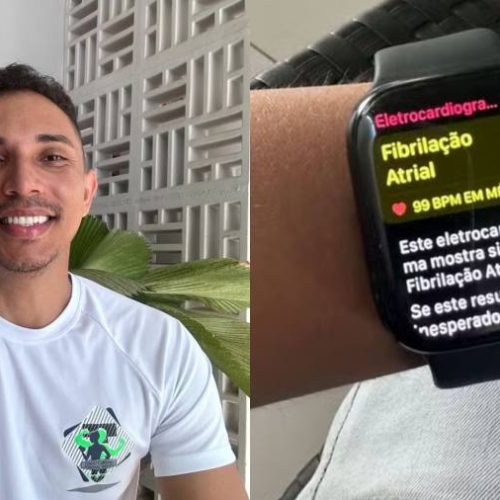 Personal trainer quase morre, mas é salvo por notificação de relógio inteligente