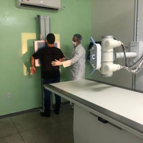 Novo equipamento amplia qualidade do serviÃÂ§o de radiografia ofertado aos usuÃÂ¡rios do HDT-UFT