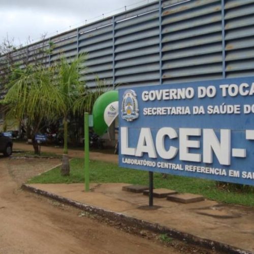 Lacen confirma mais 72 novos casos de Covid-19