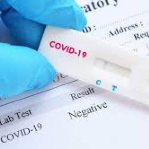 Tocantins contabiliza 113 novos casos confirmados da Covid-19